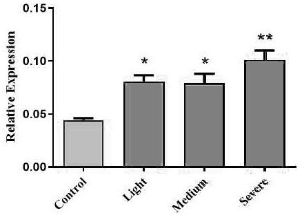 Application of PDIA6 in preparation of medicine for treating and repairing spinal cord injury