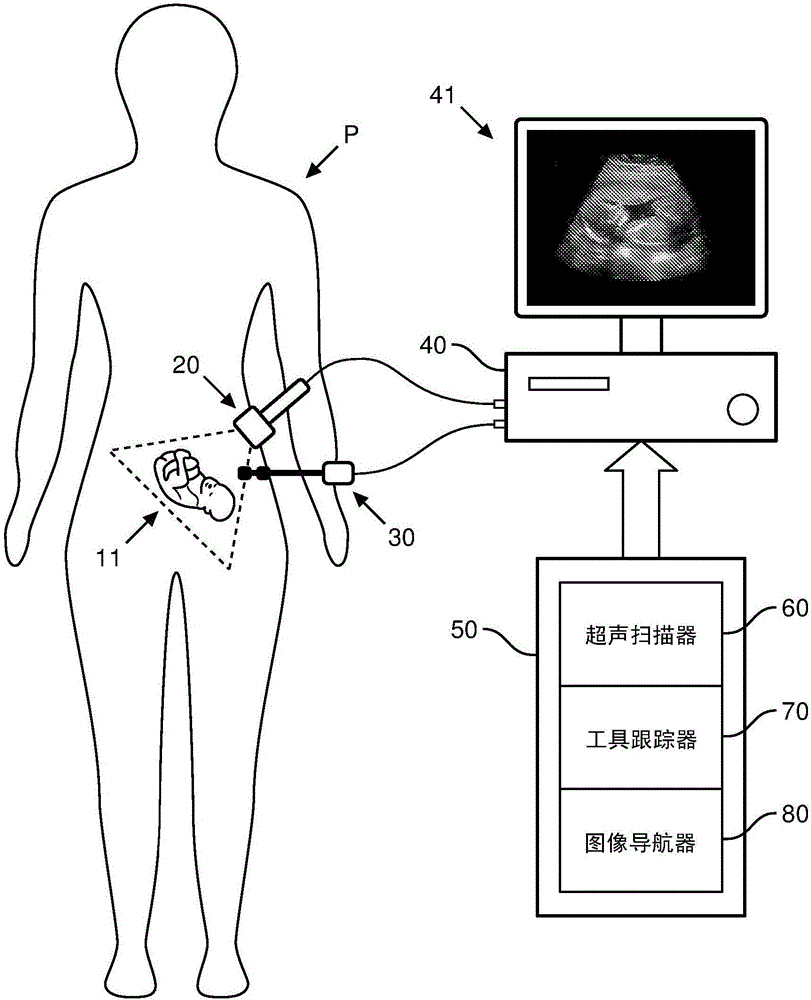 Instrument alignment and tracking with ultrasound imaging plane