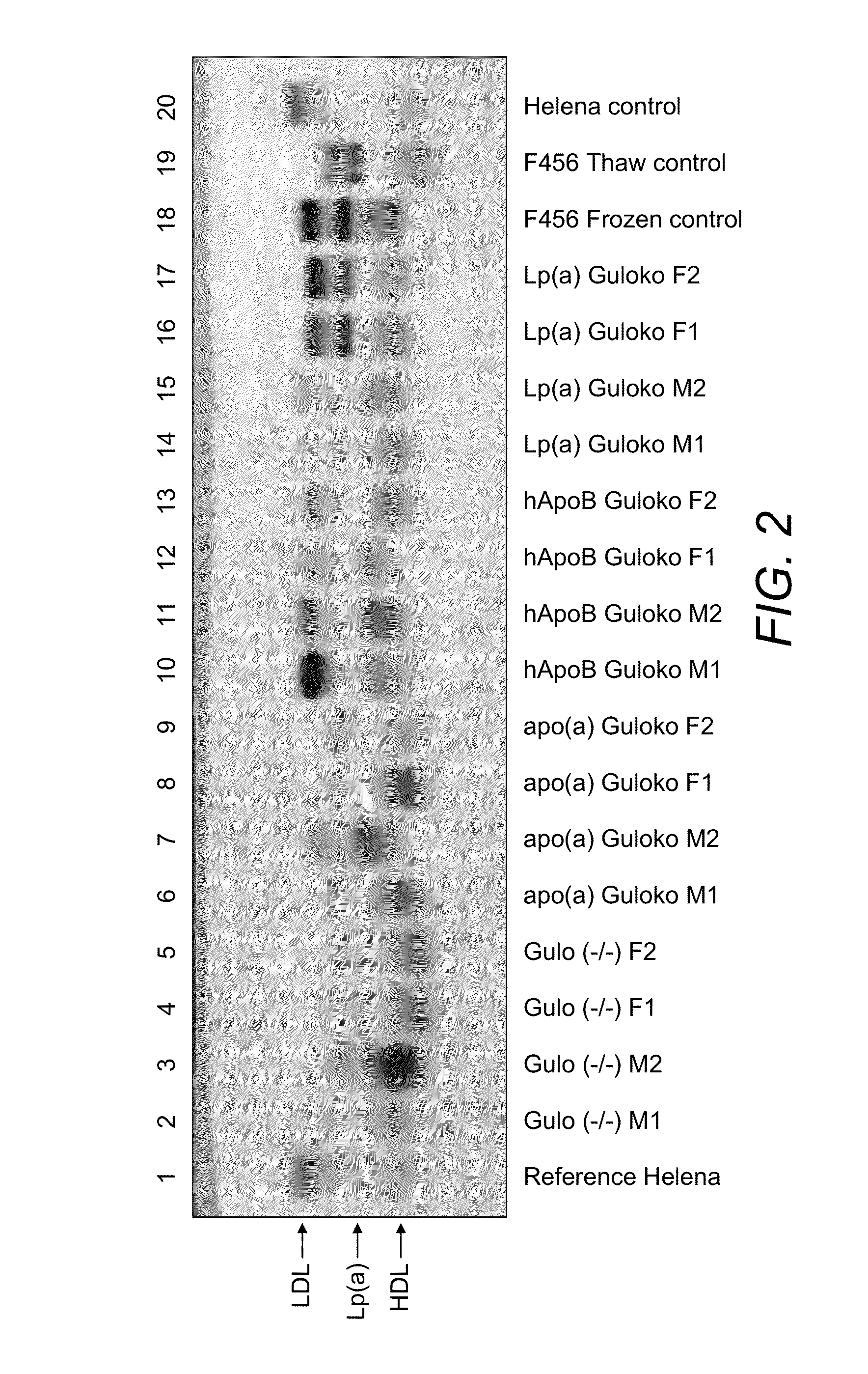 Transgenic mouse expressing human lipoprotein (a) with disabled vitamin c gene and its use as a disease treatment model