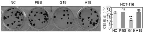 Polypeptide for treating metastatic tumors and preparation method and application of polypeptide for treating metastatic tumors