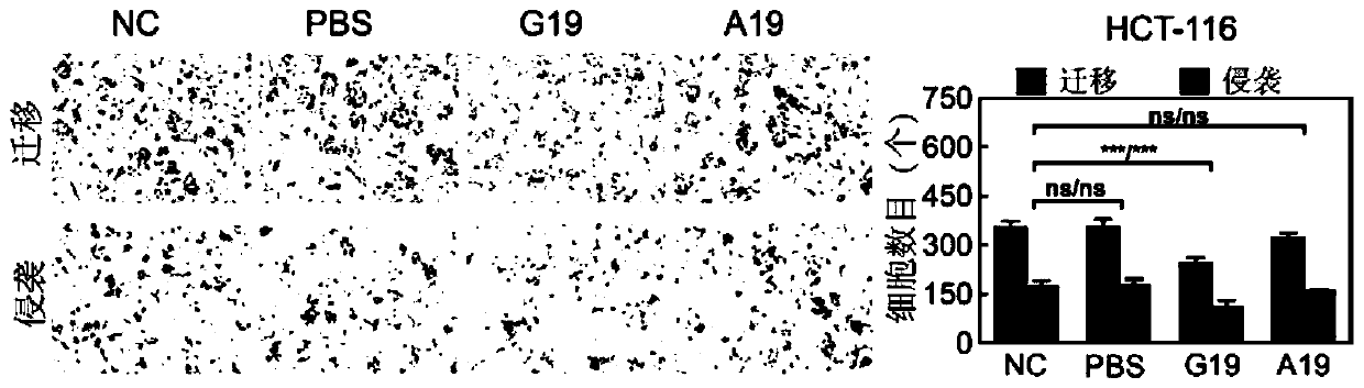 Polypeptide for treating metastatic tumors and preparation method and application of polypeptide for treating metastatic tumors