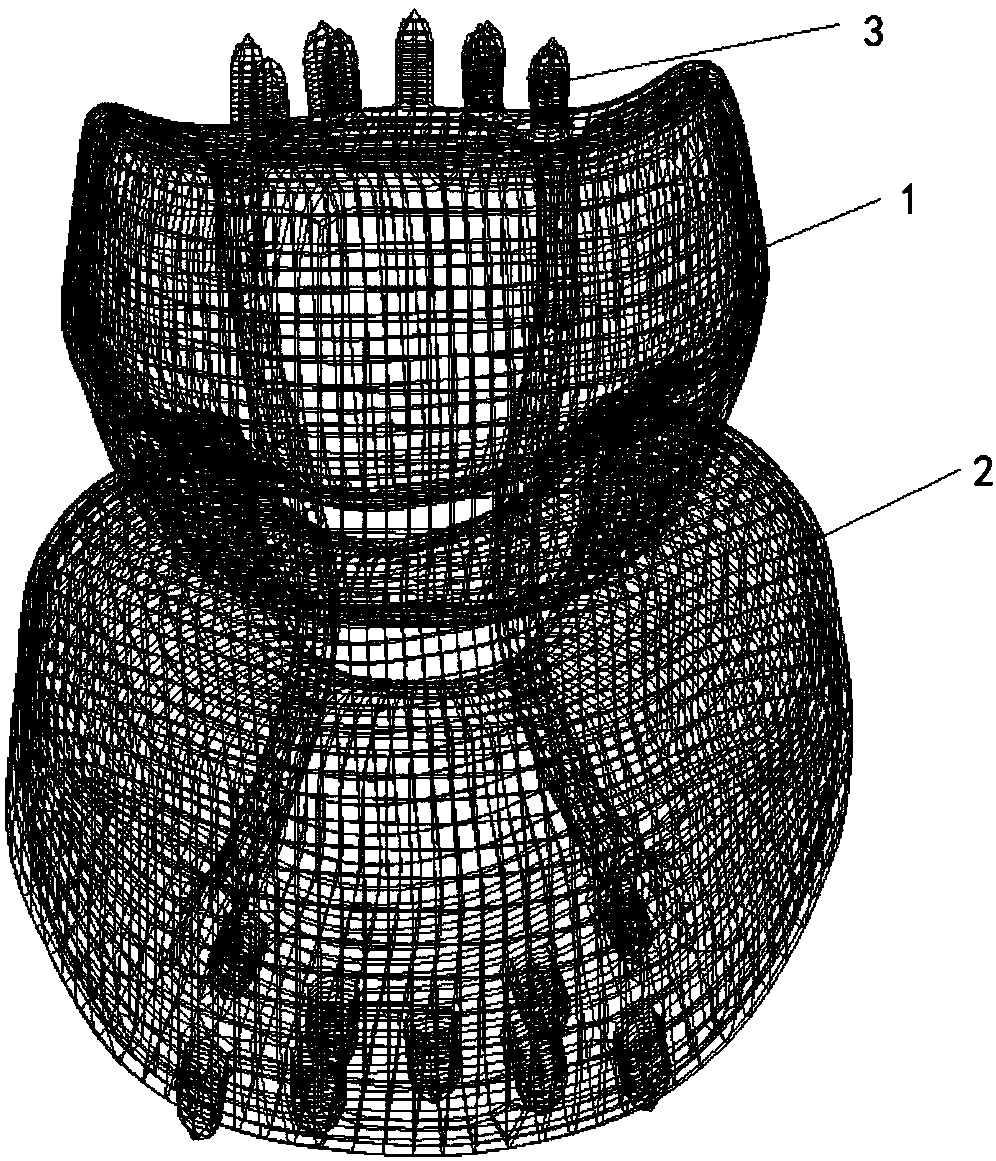 Cervical total spondylectomy implantable prosthesis device of 3D printing