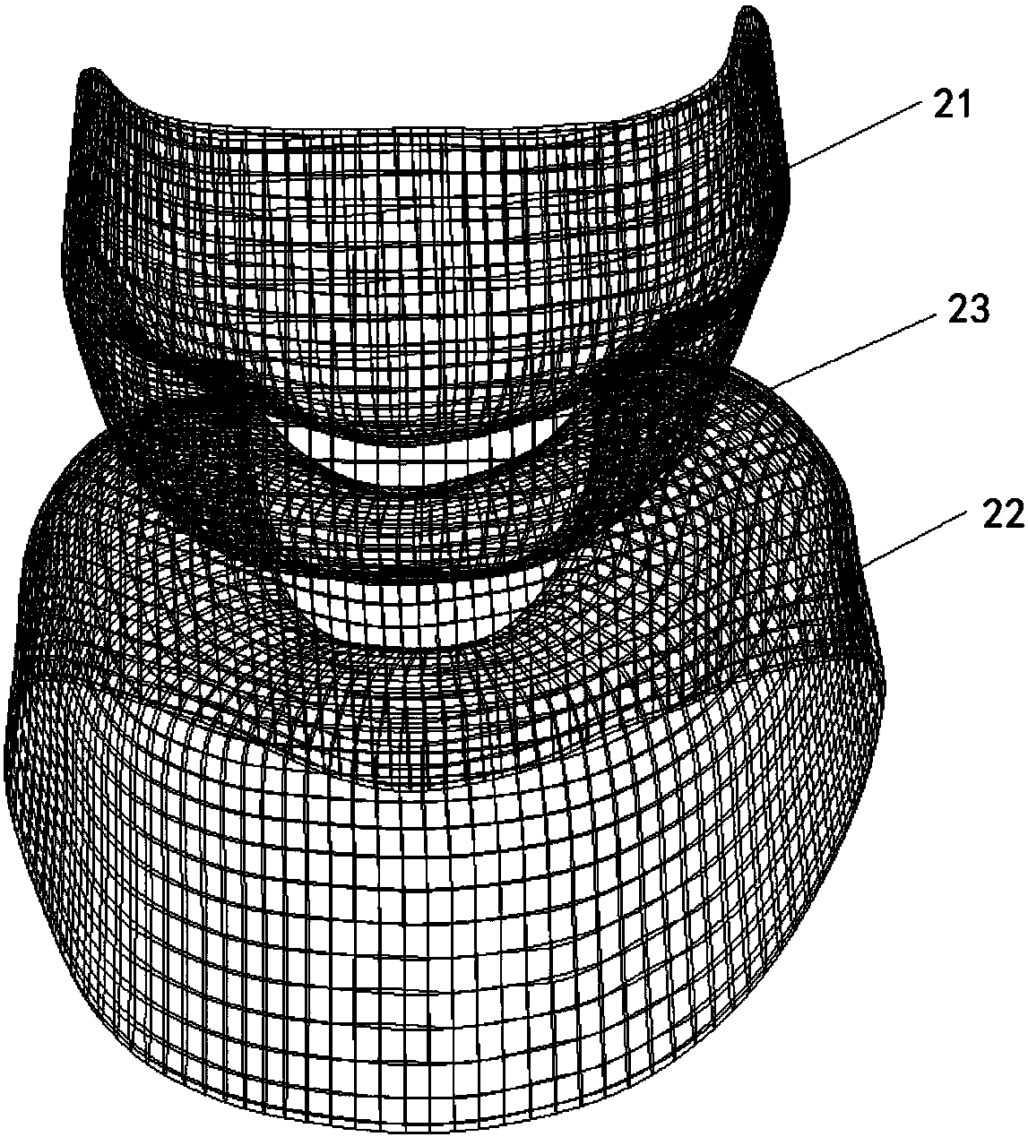 Cervical total spondylectomy implantable prosthesis device of 3D printing