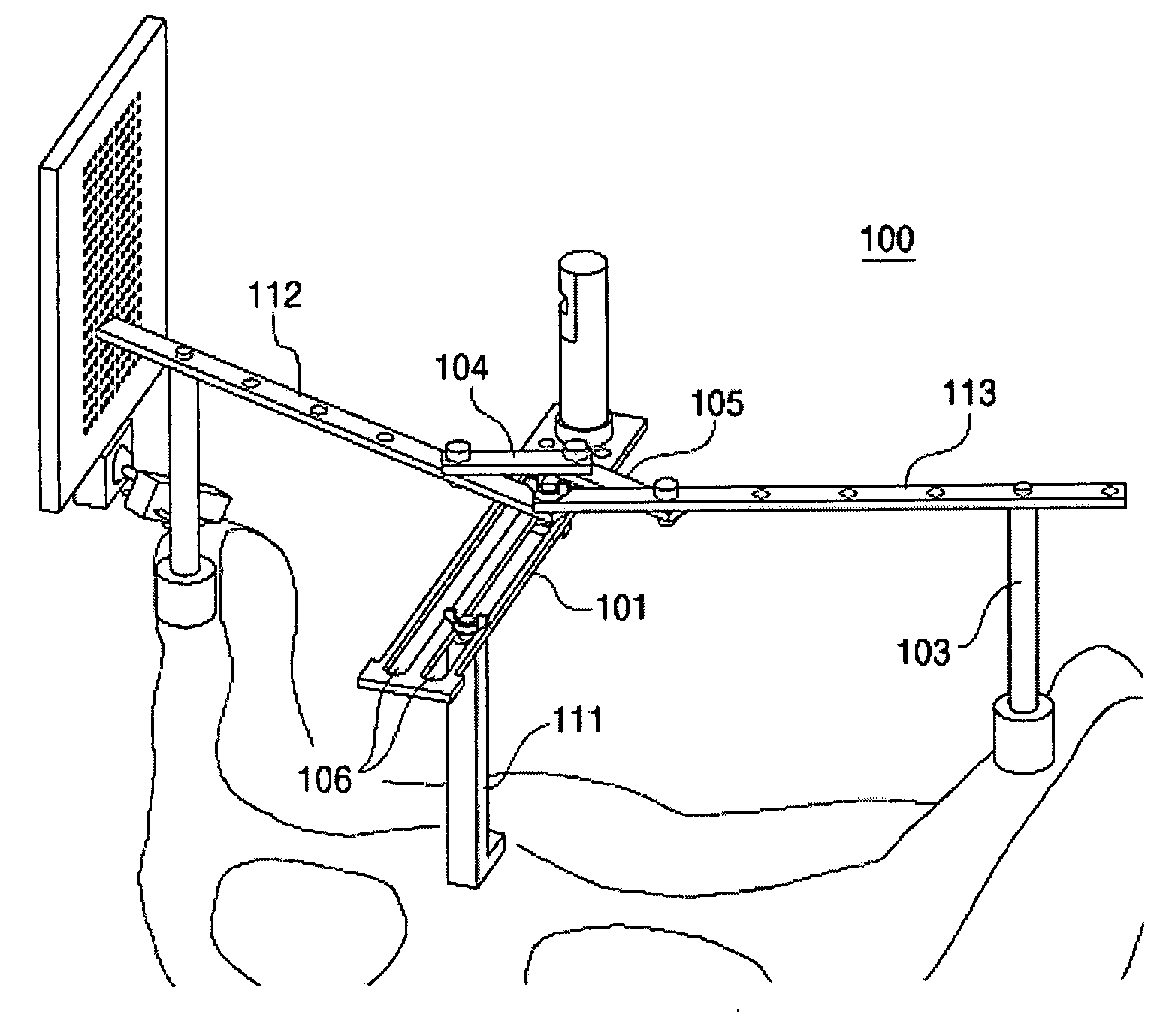 Navigation System for Hip Replacement Surgery Having Reference Mechanism and Method Using the Same