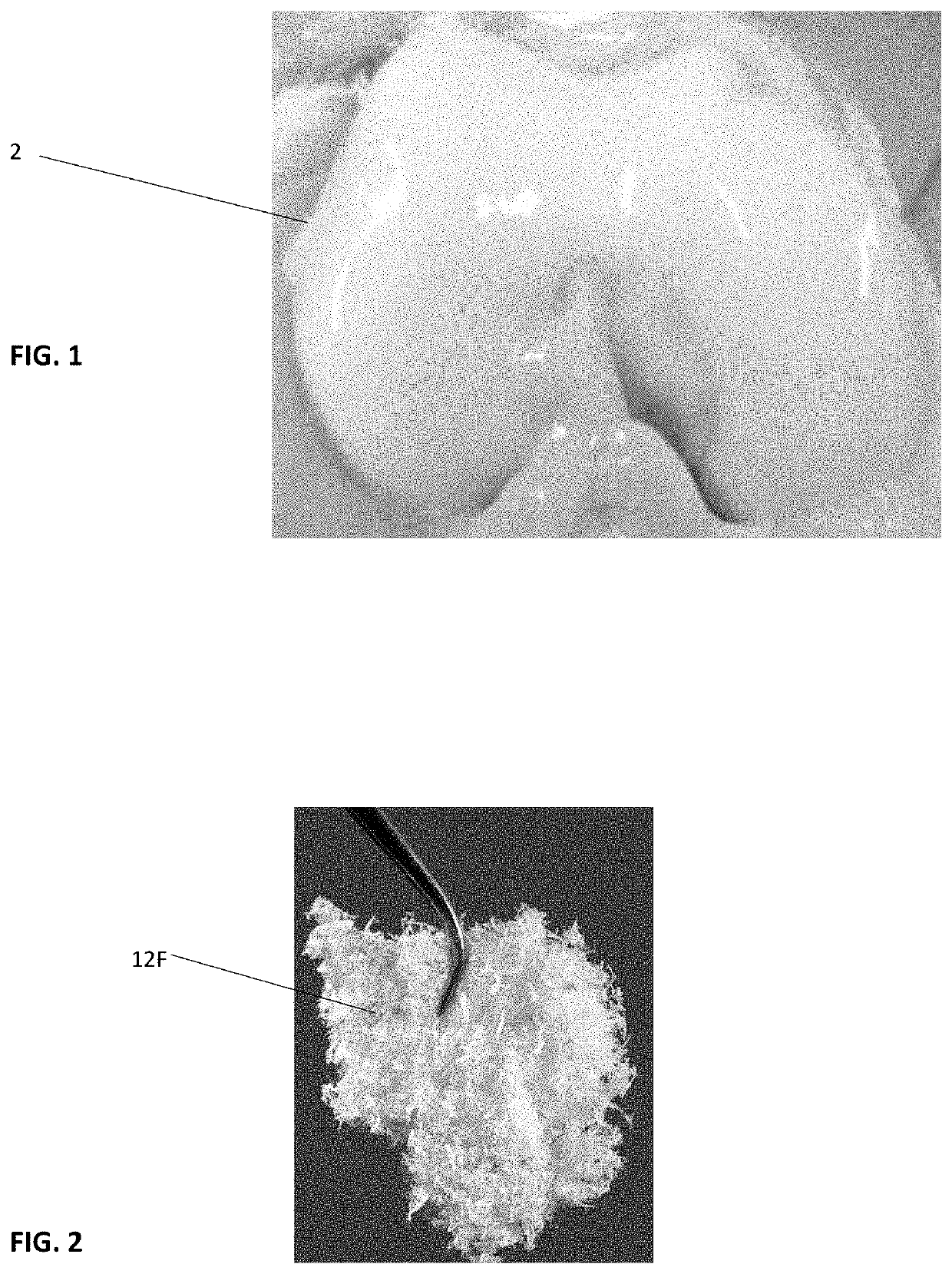 Infused cartilage particles