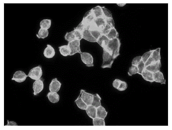 Application of pyrazinamide in the preparation of drugs for inhibiting tumor cell metastasis and spread