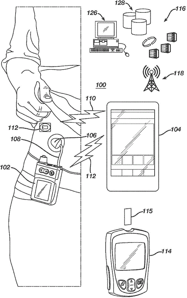 Method and system for tuning a closed-loop controller for an artificial pancreas