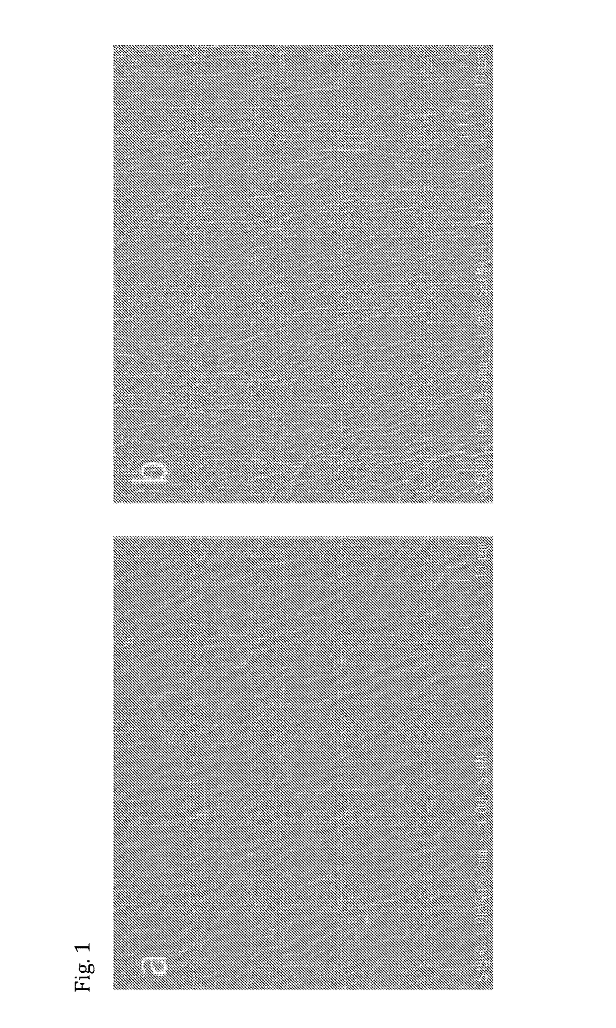 Nitric oxide-releasing wound treatment film and preparation method therefor