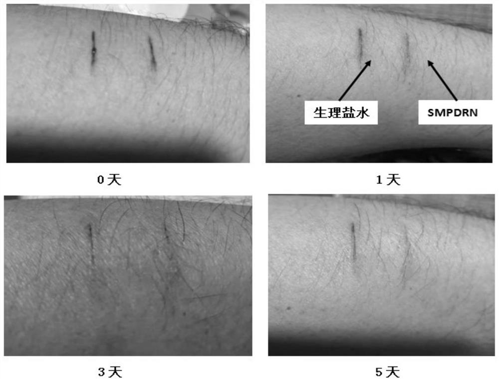 Dressing with functions of hemostasis and accelerated wound healing and preparation method thereof