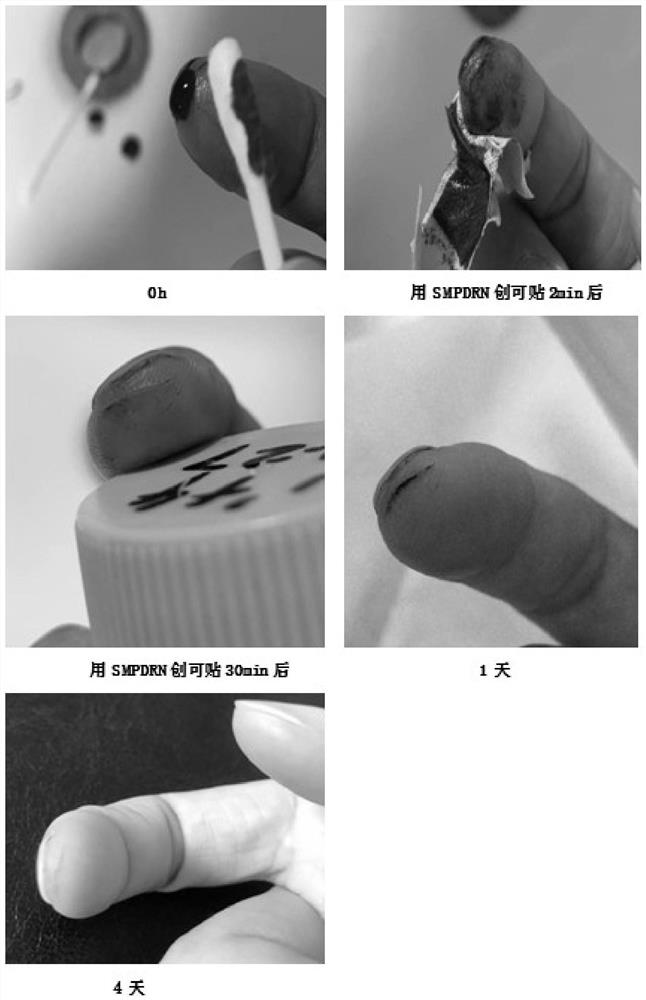 Dressing with functions of hemostasis and accelerated wound healing and preparation method thereof