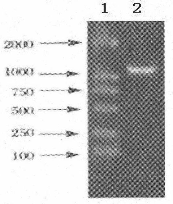 VSIG4 (V-set and Ig domain containing 4) and IGRP (glucose-6-phosphatase catalytic subunit-related protein) dual-gene coexpression recombinant adenovirus as well as preparation method and application thereof