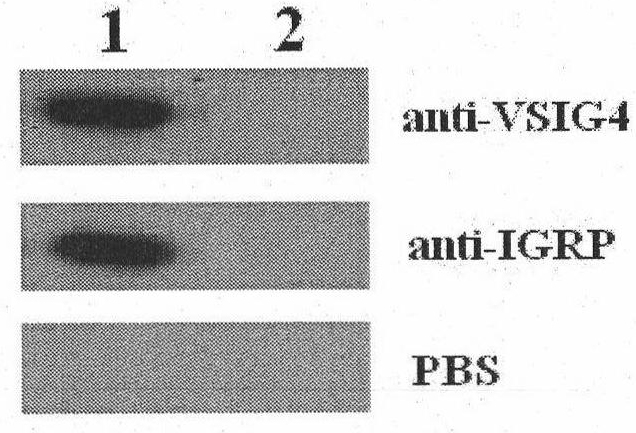 VSIG4 (V-set and Ig domain containing 4) and IGRP (glucose-6-phosphatase catalytic subunit-related protein) dual-gene coexpression recombinant adenovirus as well as preparation method and application thereof