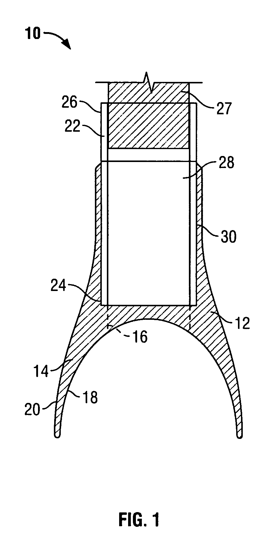 Respiratory mask having intraoral mouthpiece with large sealing area and multiple sealing configuration
