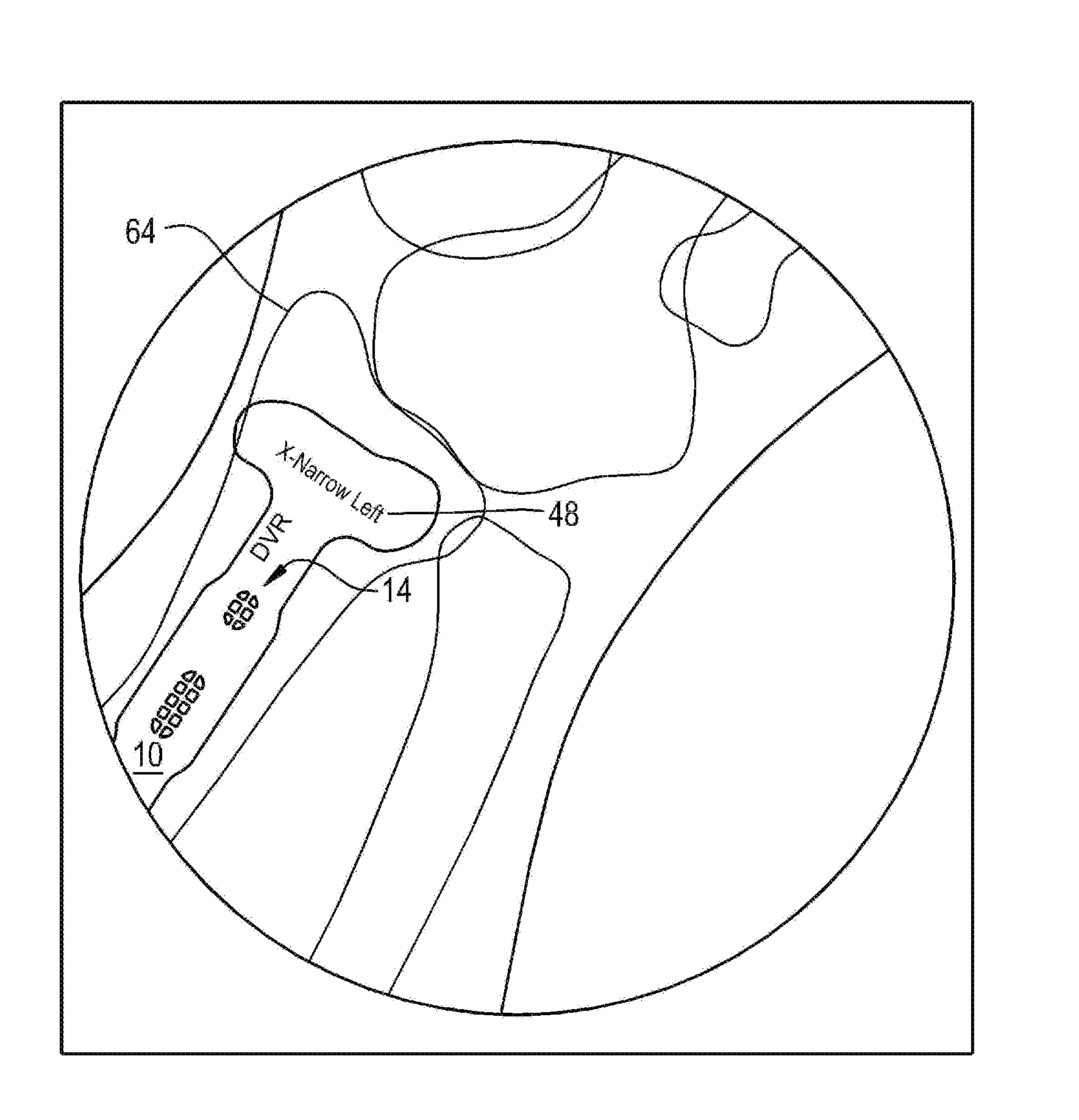 Orthopaedic implant template and method of making