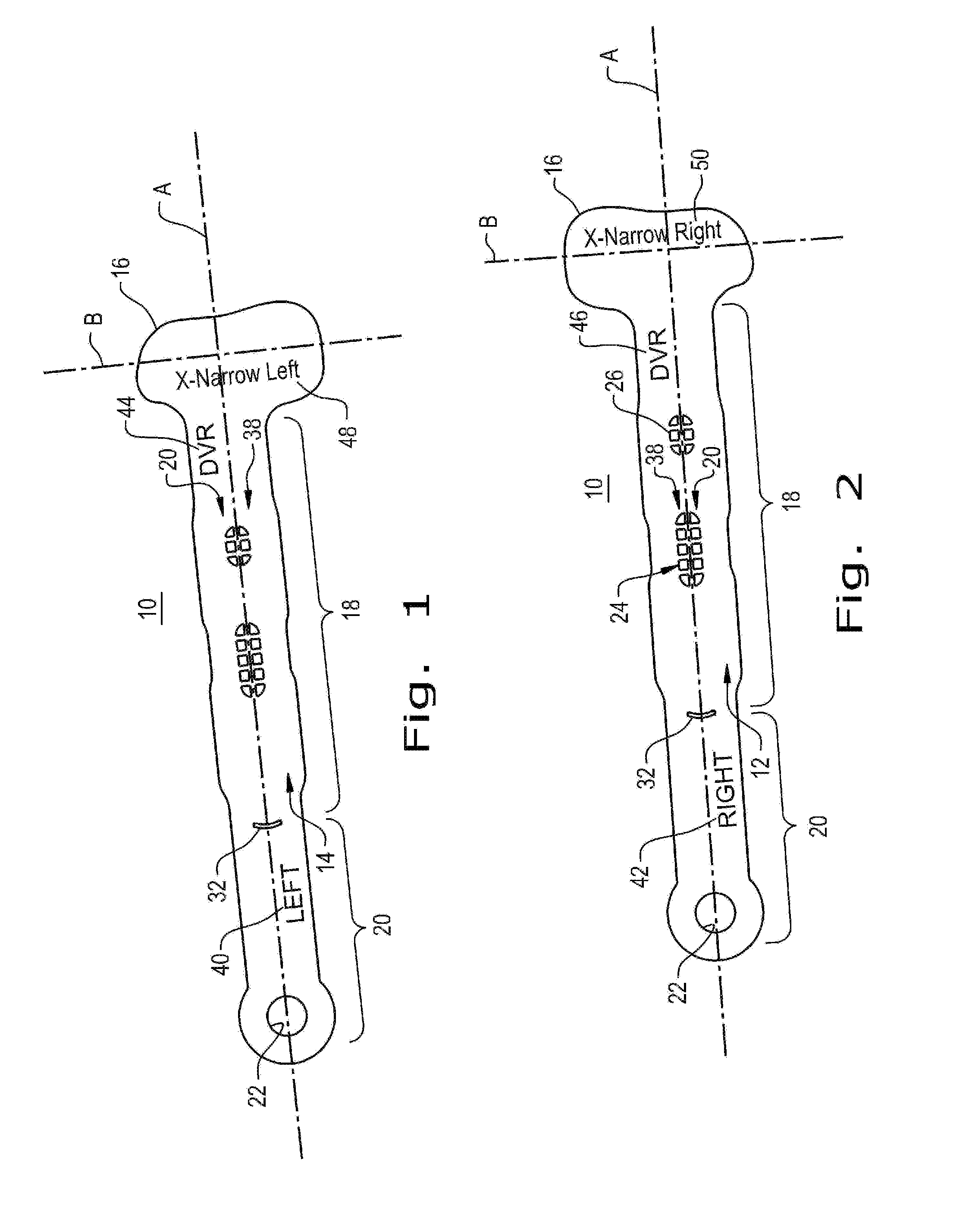 Orthopaedic implant template and method of making