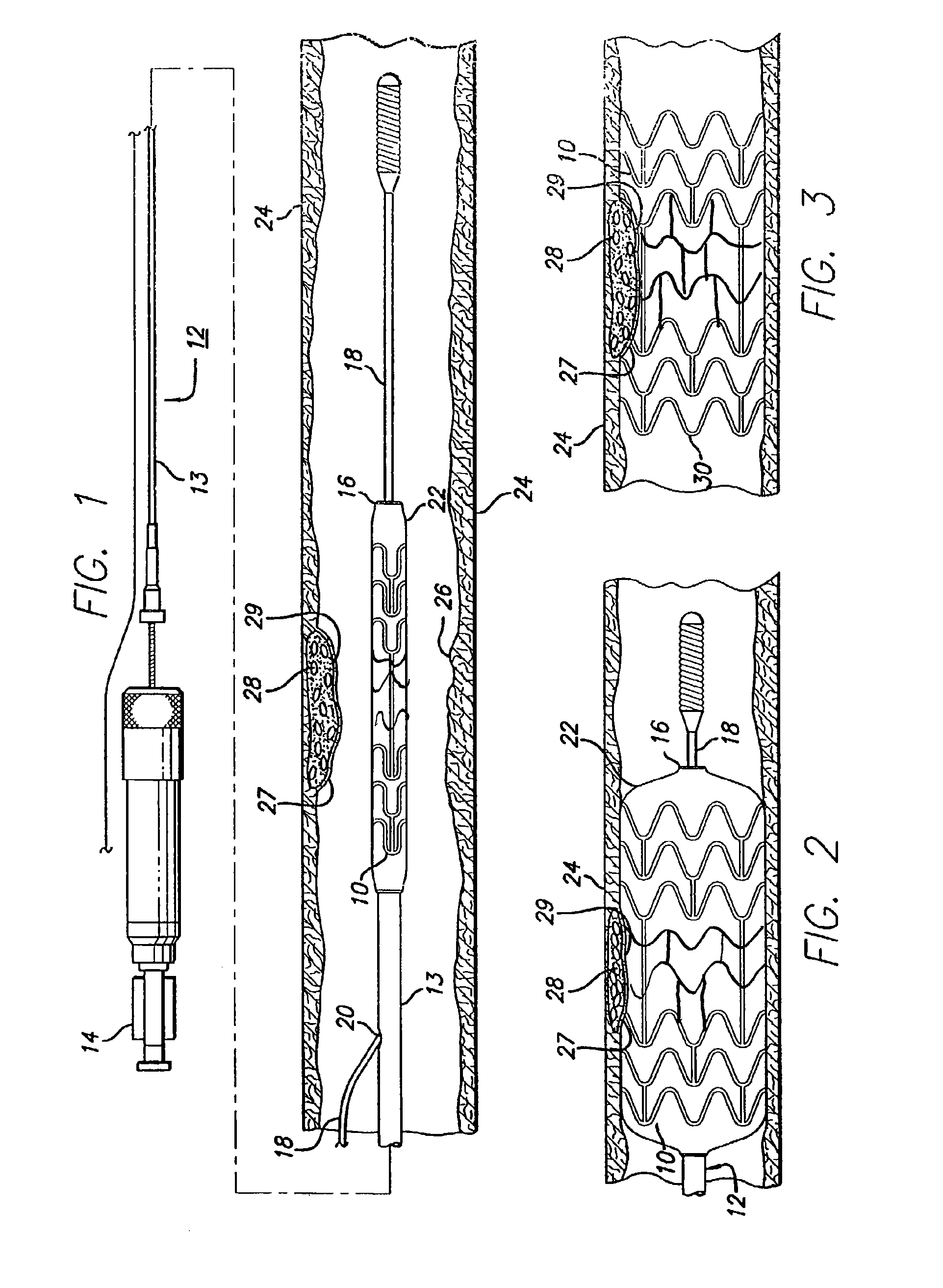 Medical device of ternary alloy of molybdenum and rhenium