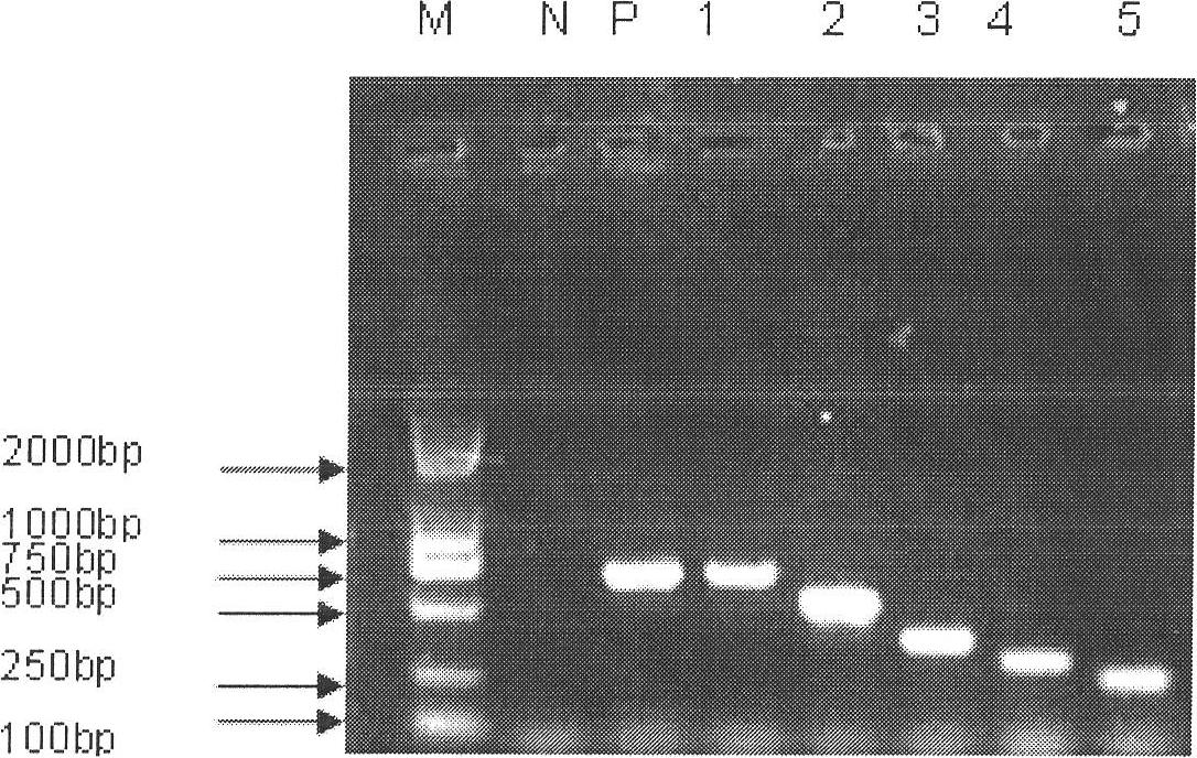 Specific primers and kit for detecting various serotype pathogenic bacteria of legionella pneumophilia