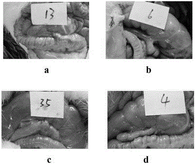 Medical carboxymethyl chitosan anti-adhesion agent and preparation method thereof