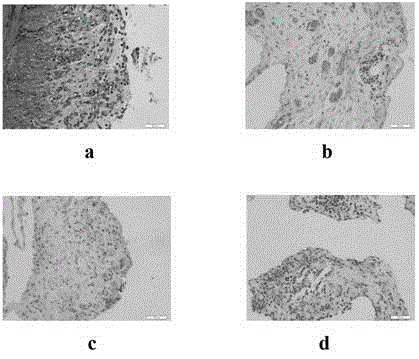 Medical carboxymethyl chitosan anti-adhesion agent and preparation method thereof
