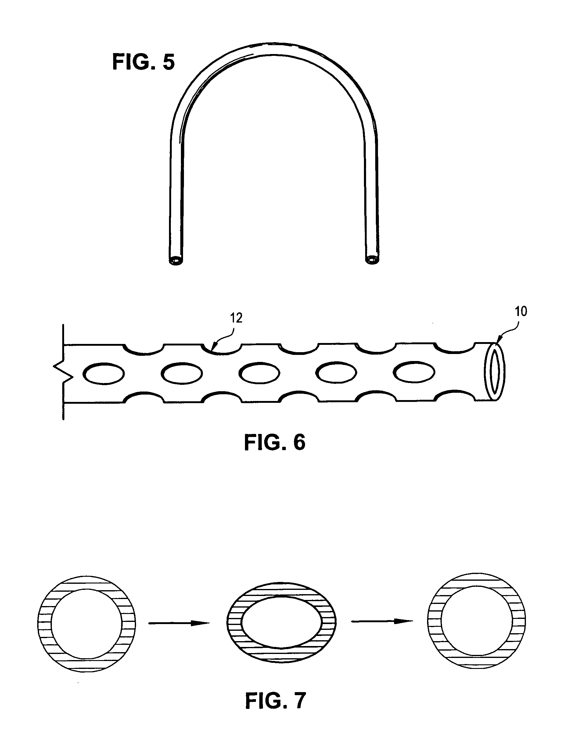 Tubular orthodontic arch wire