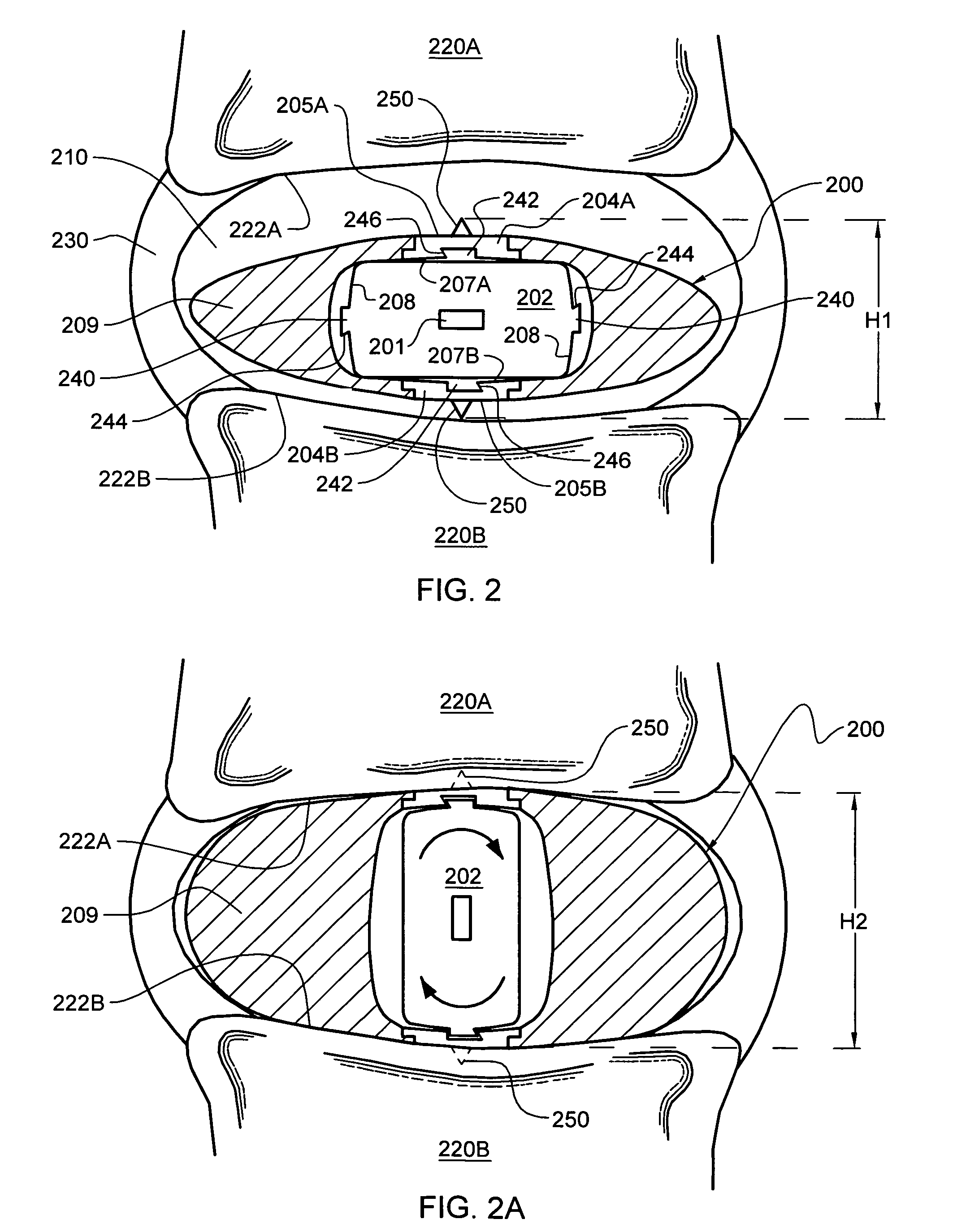 Intervertebral disc nucleus replacement implants and methods