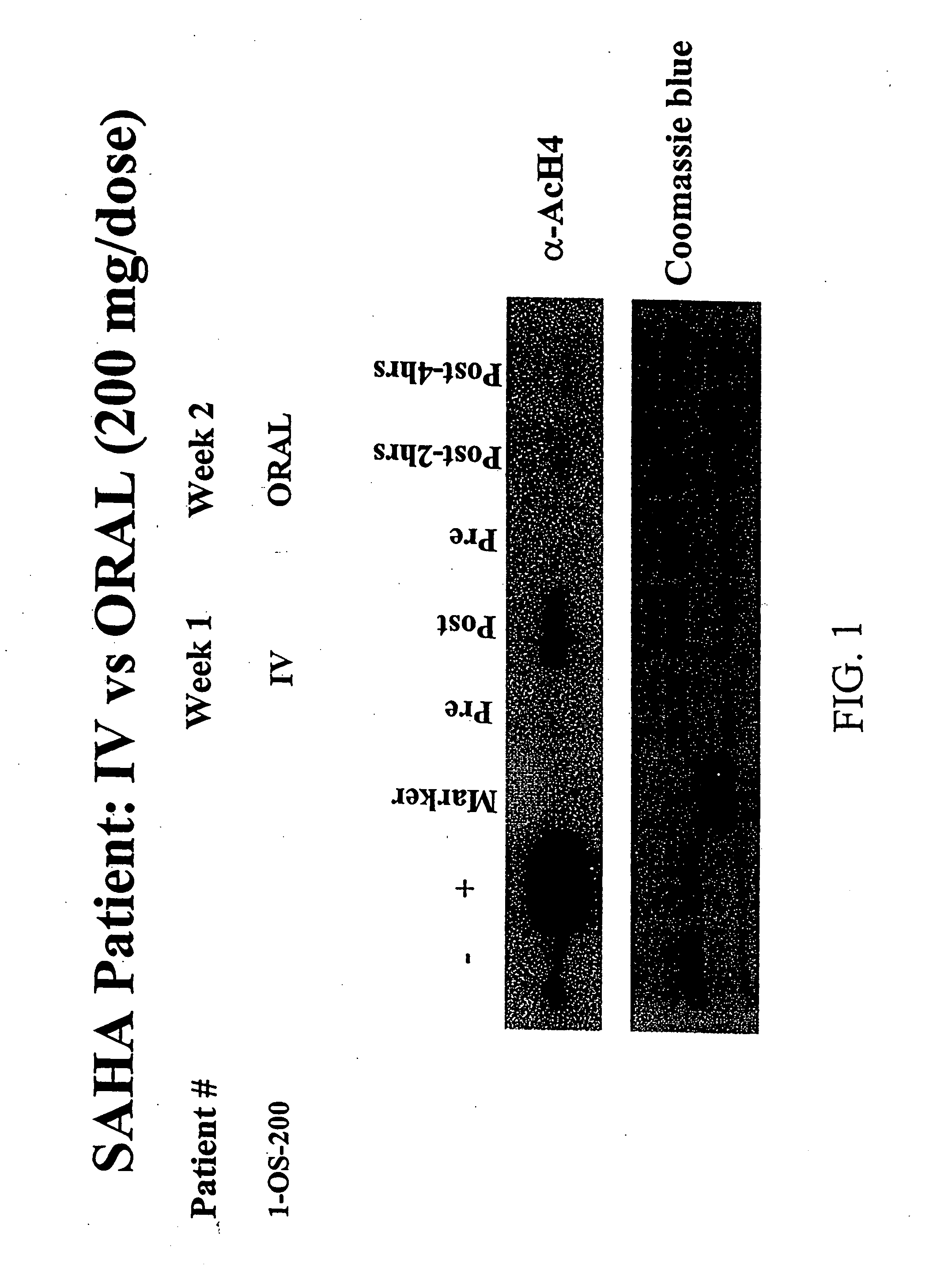 Polymorphs of suberoylanilide hydroxamic acid