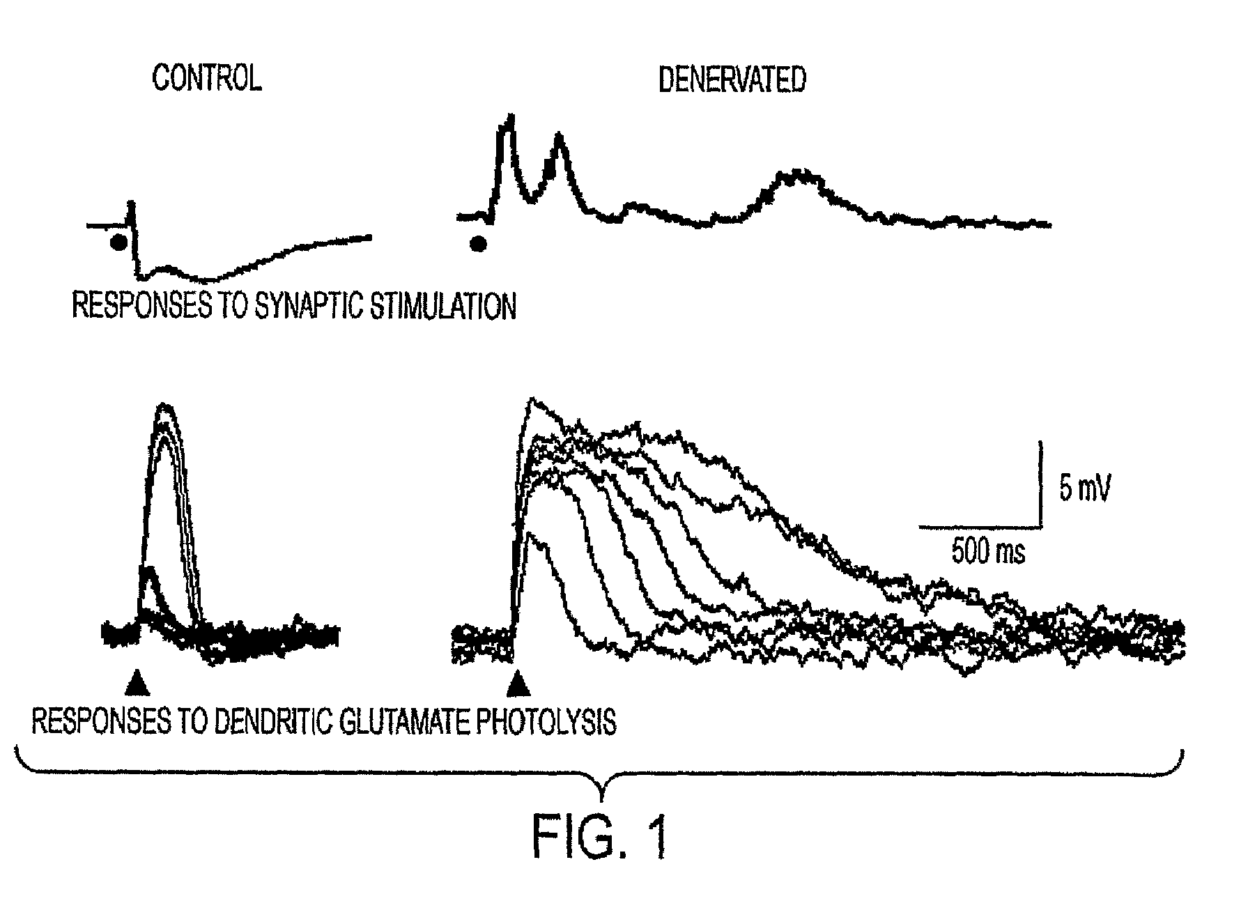 Method for treating central pain syndrom or for inducing centrally generated pain in an animal model