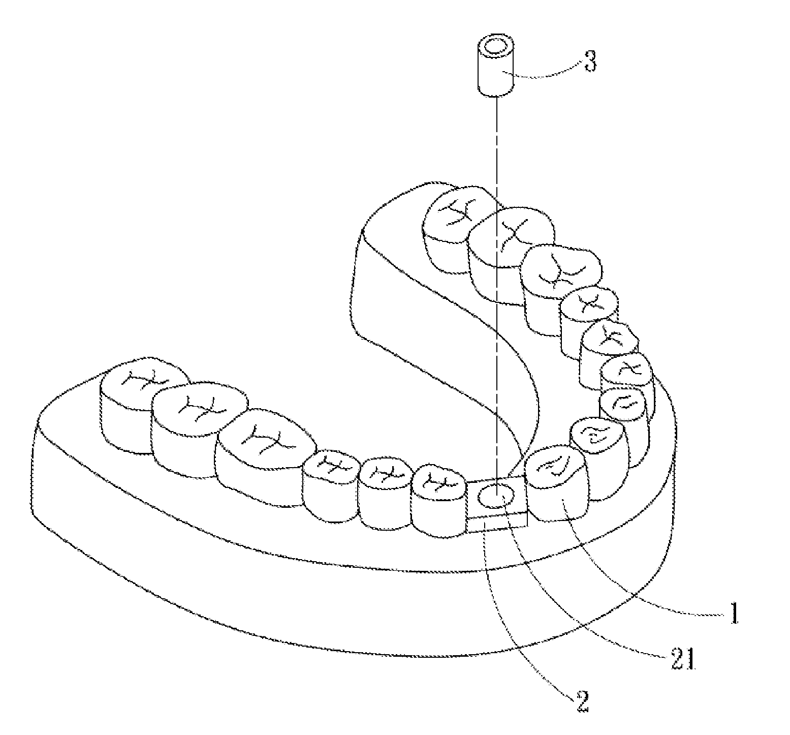 Dental positioning stent, and manufacturing method, using method and components for the same