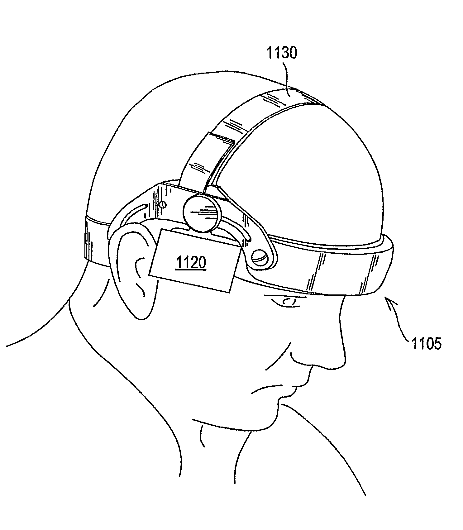 Ultrasound Apparatus and Method to Treat an Ischemic Stroke