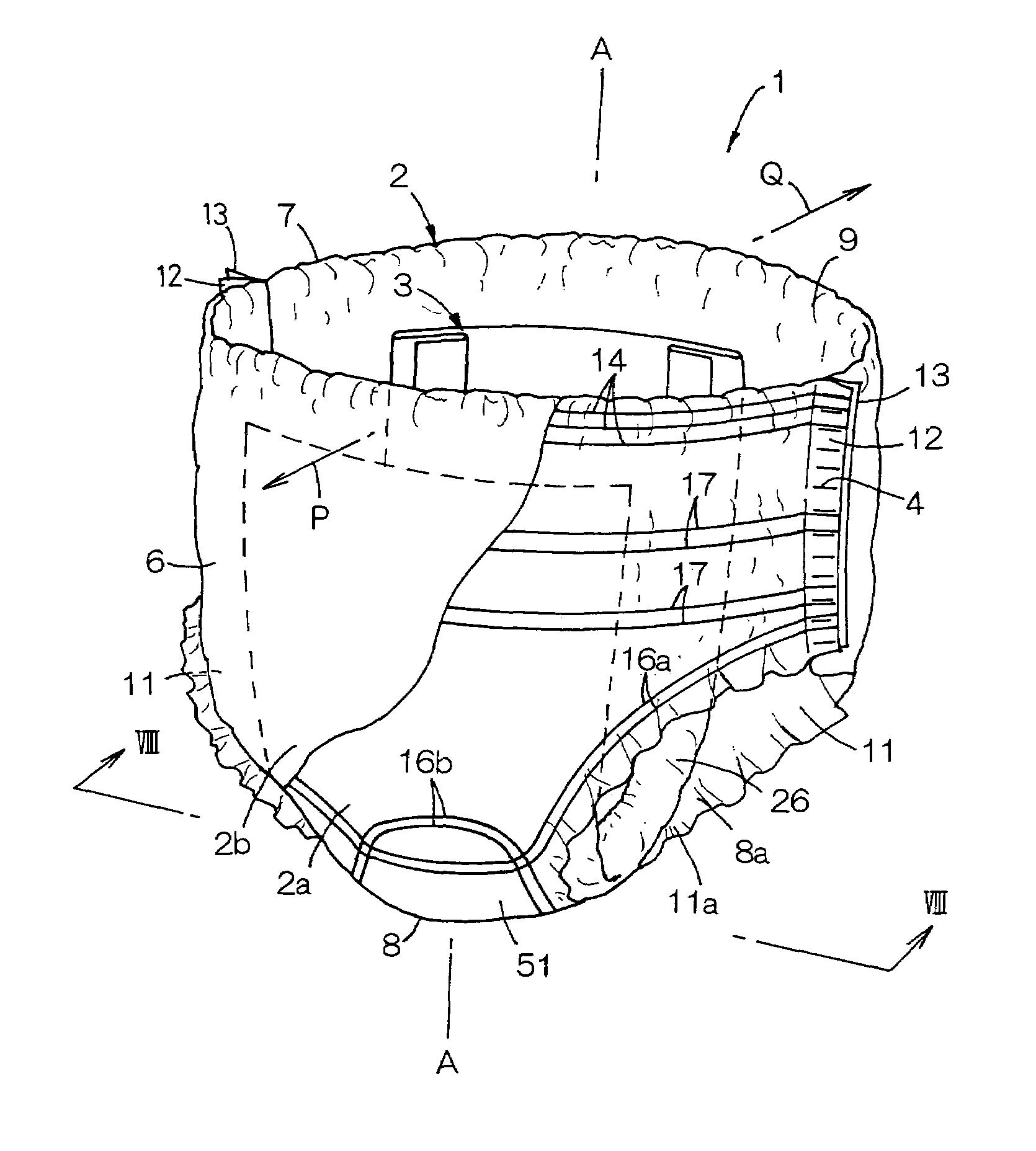Disposable wearing article having multilayered core comprising convex gaps and v-shaped cutouts