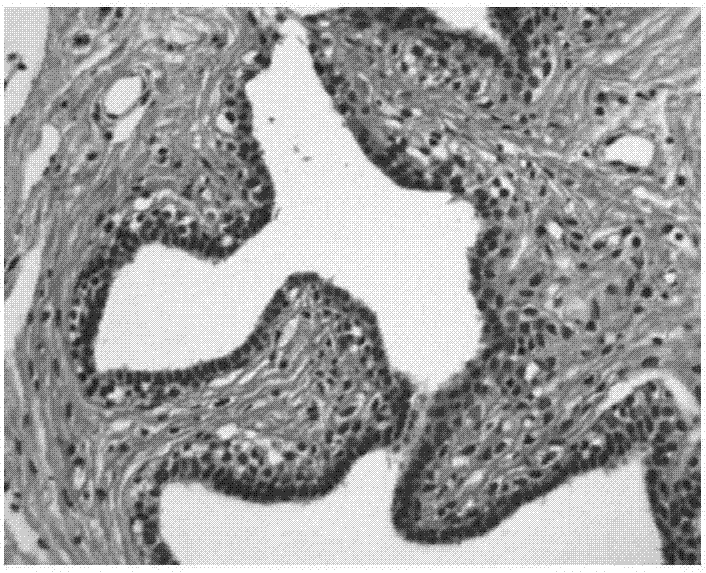 Chinese patent medicine for treating breast diseases and preparation method thereof