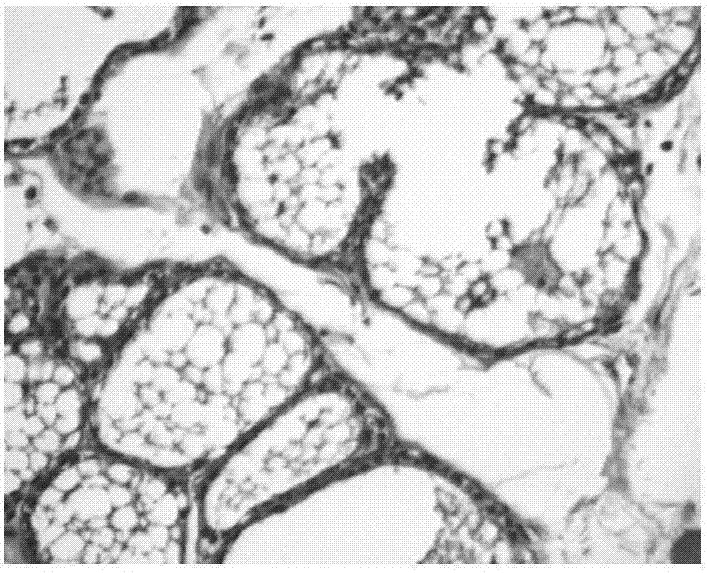 Chinese patent medicine for treating breast diseases and preparation method thereof