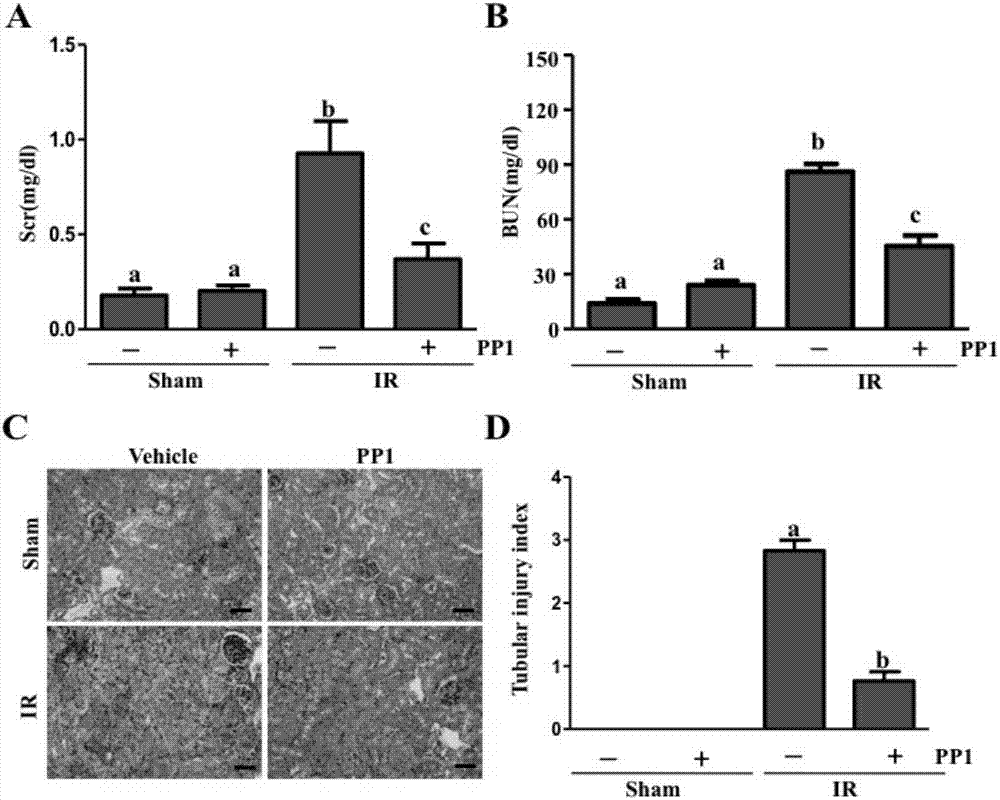 Application of Src kinase inhibitor in preparing medicaments for treating acute kidney injury