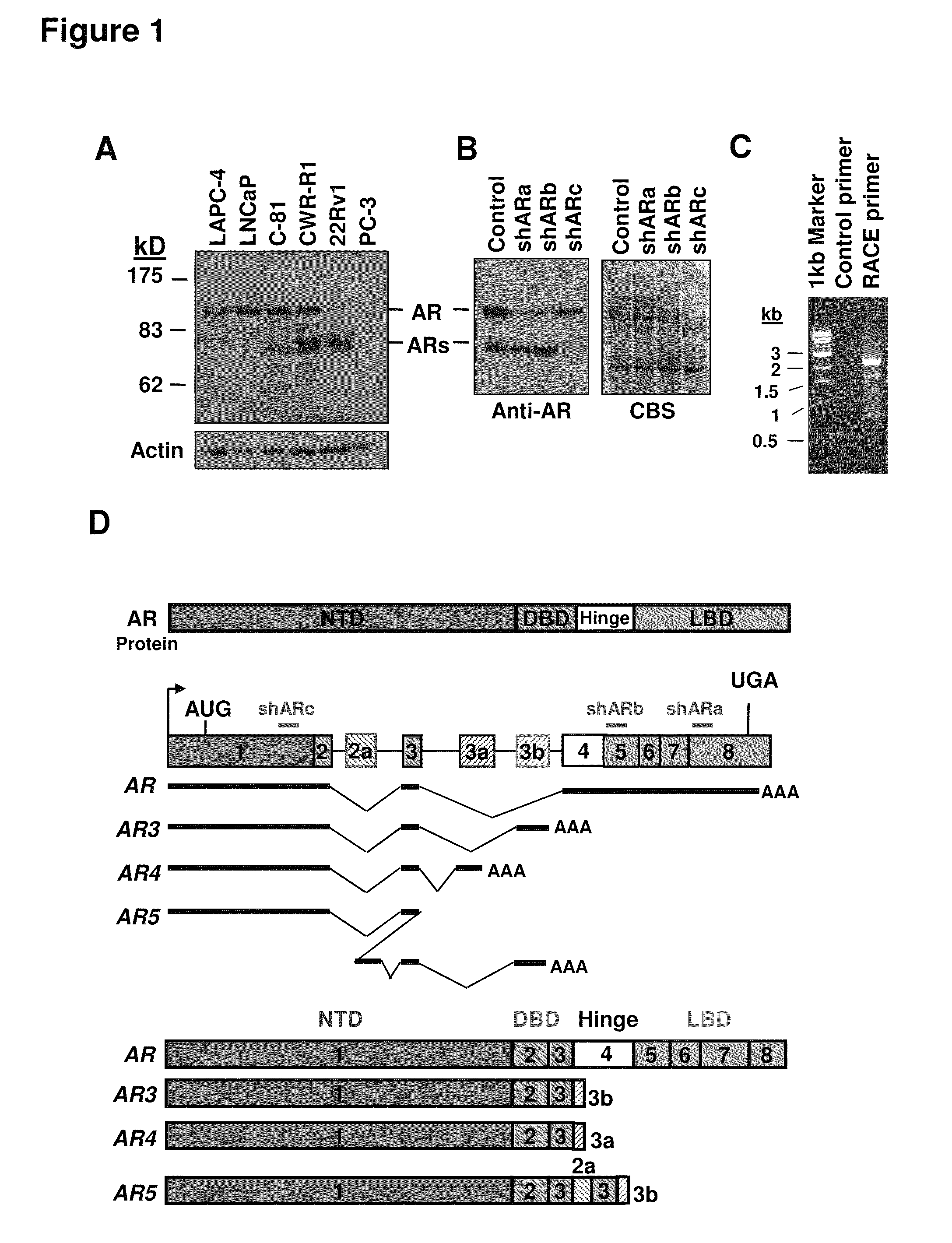 Human androgen receptor alternative splice variants