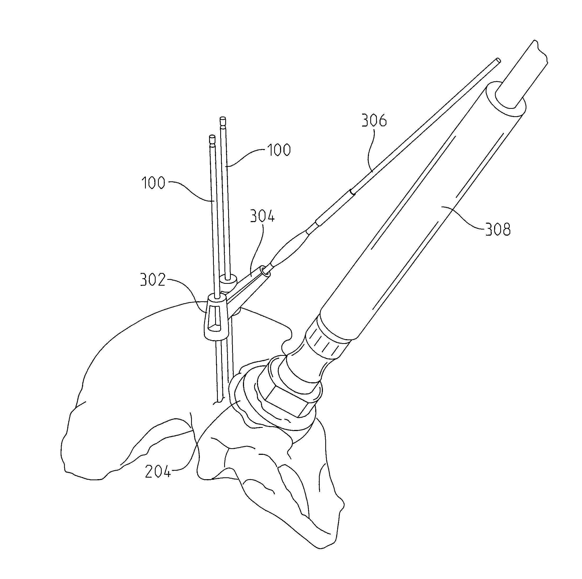 Acetabular drill pin