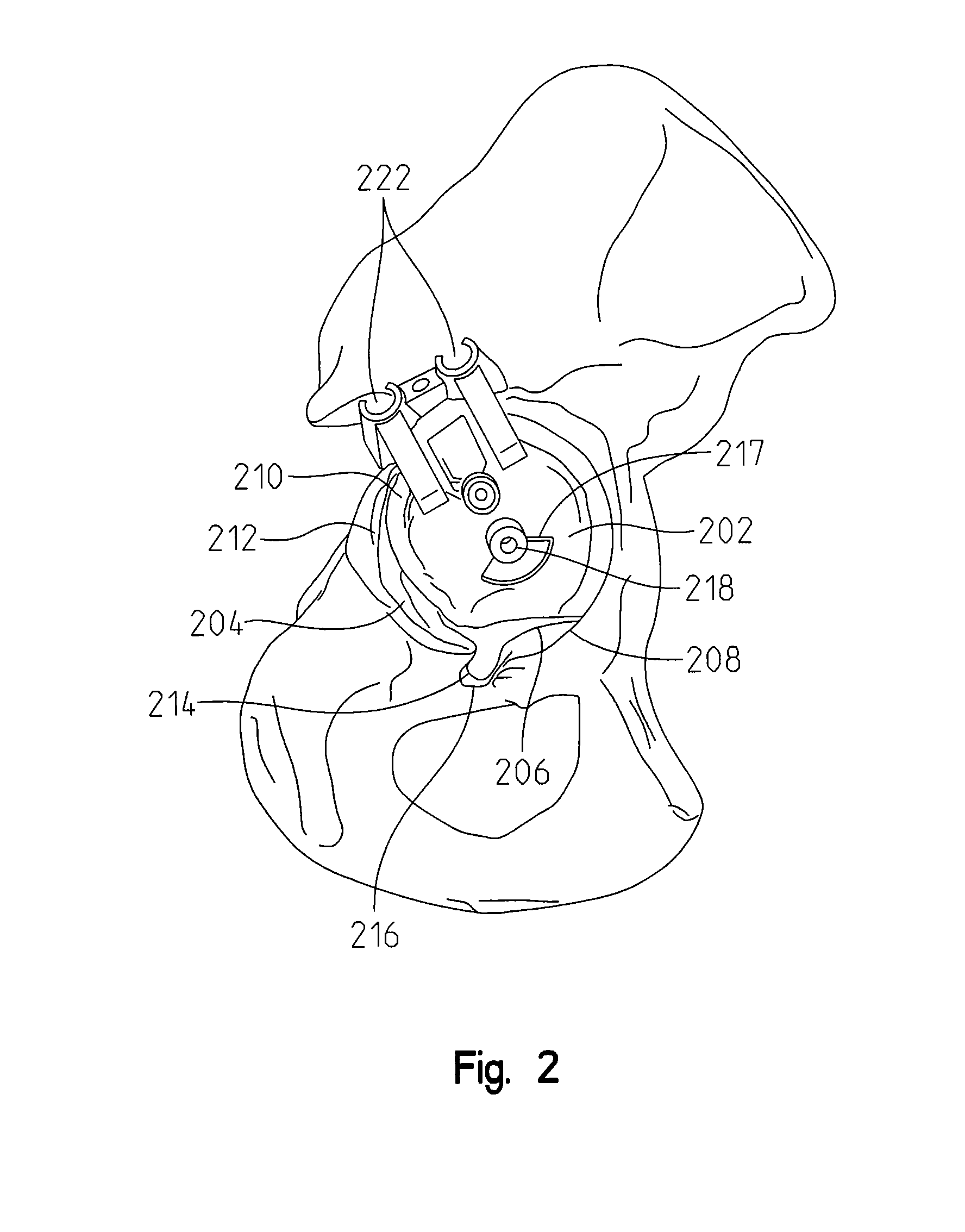 Acetabular drill pin