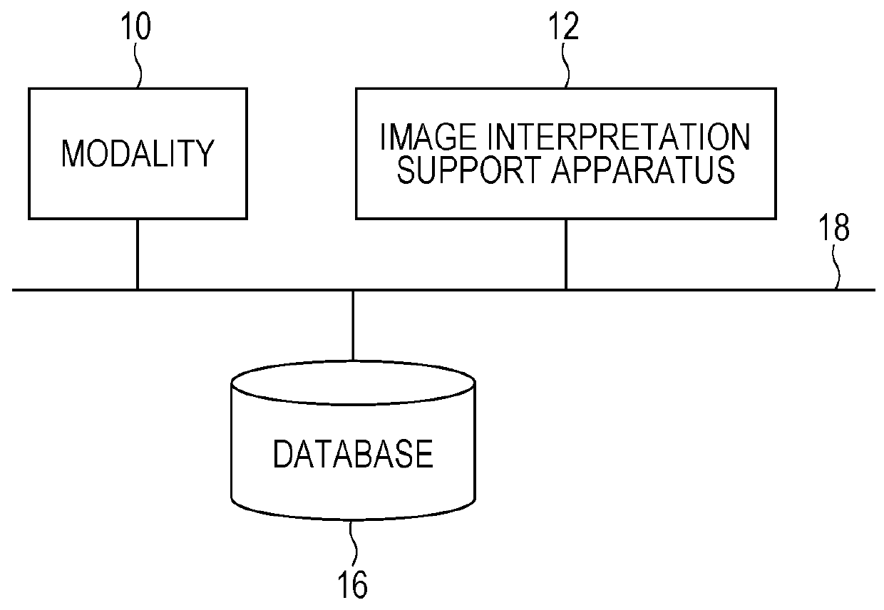 Image interpretation support apparatus and method