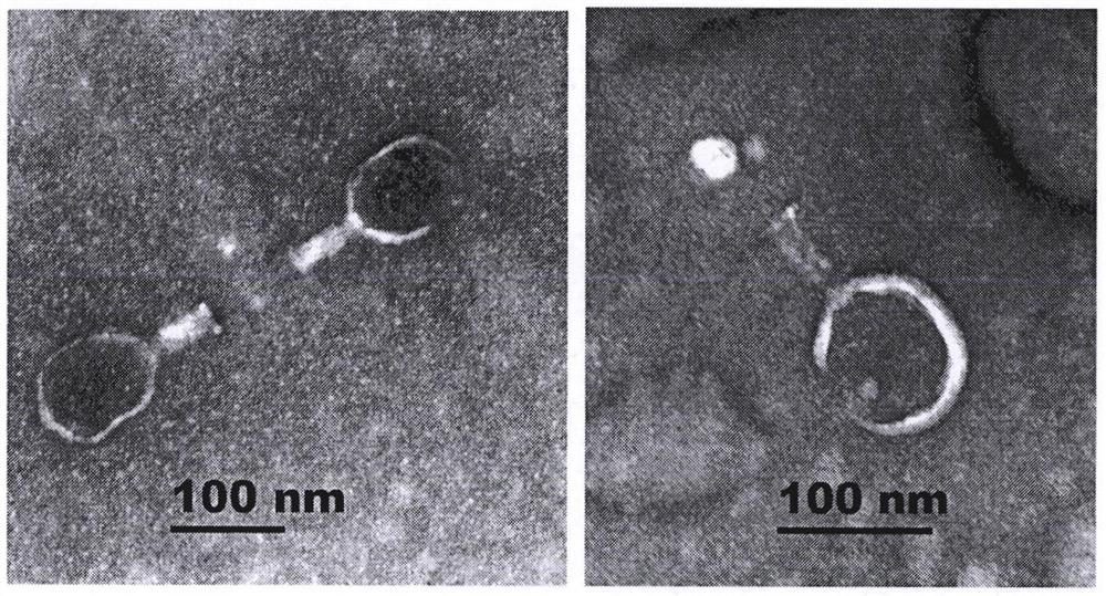 Edwardsiella tarda high-efficiency lytic bacteriophage vB_EtaM-IME523 and application thereof