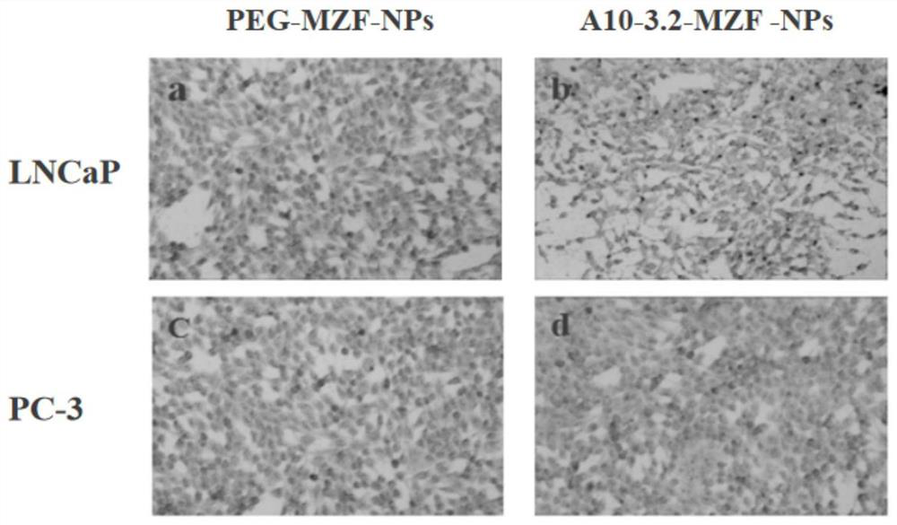 Molecular probe APT10-3.2-MZF-NPs for diagnosing prostatic cancer and preparation method of molecular probe APT10-3.2-MZF-NPs