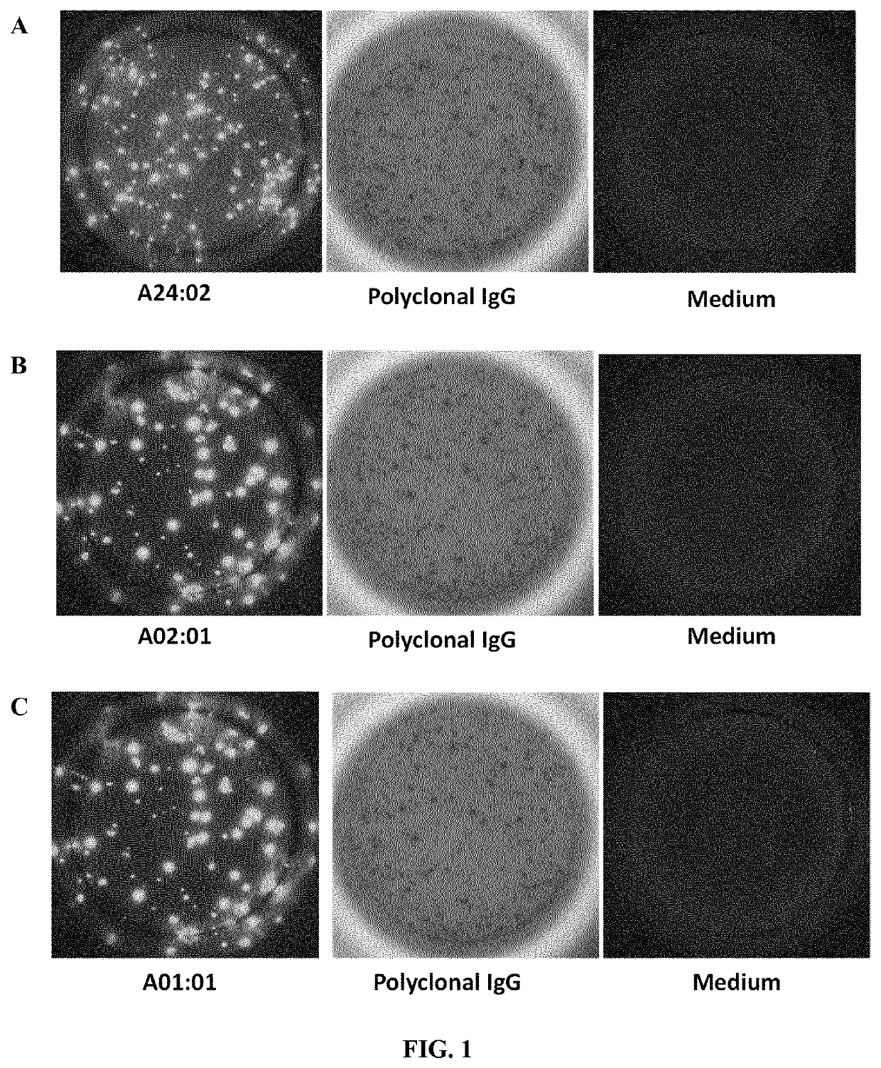 Method for detecting antibody-secreting B cells specific for HLA