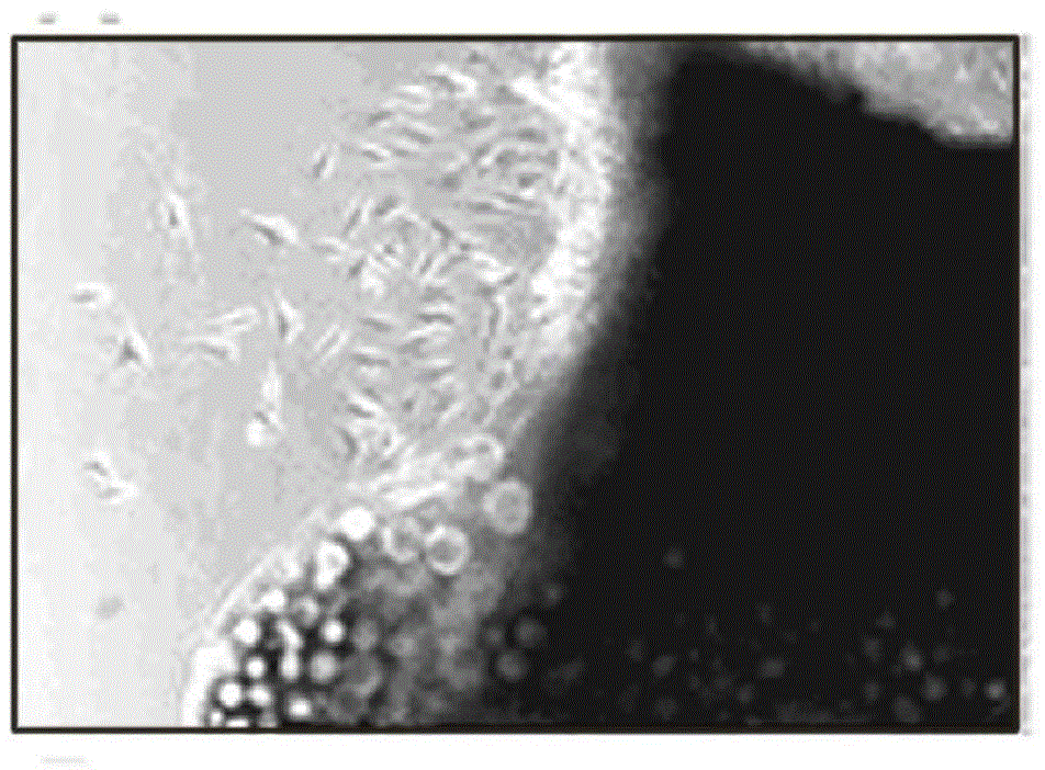 Method for inducing synovium mesenchymal stem cells to be differentiated to chondrocytes by in-vitro lentivirus mediated BMP-2 (Bone Morphogenetic Protein) genes