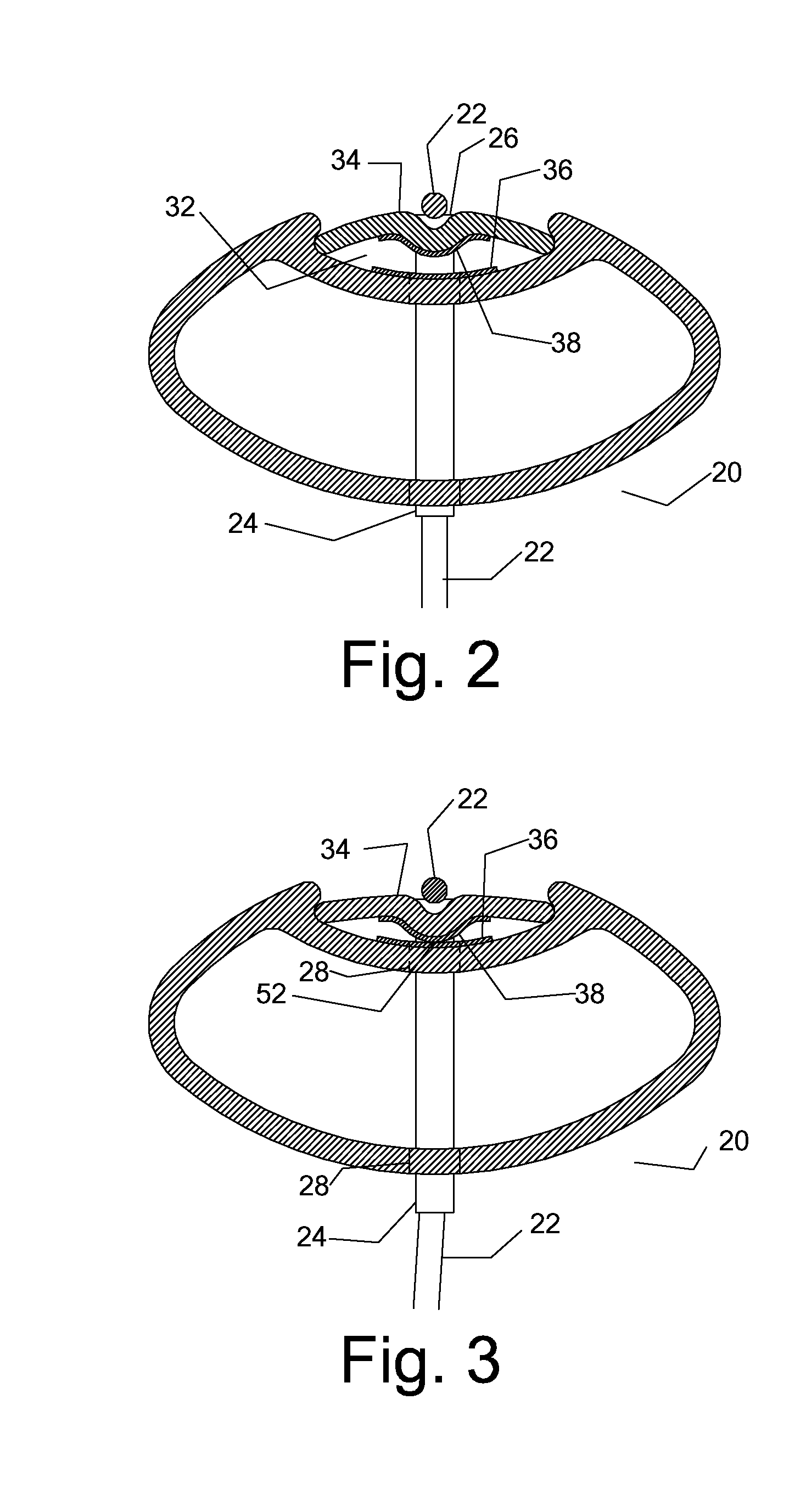 System and Method for a Game Racquet Including an Actuator