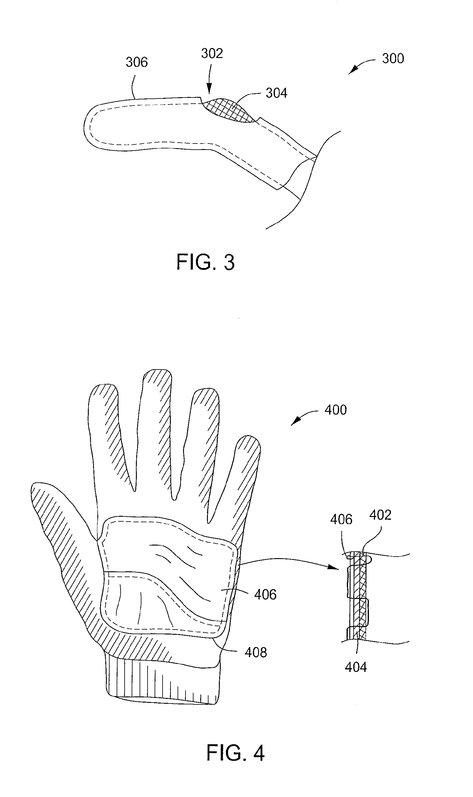 Glove having injection molded components