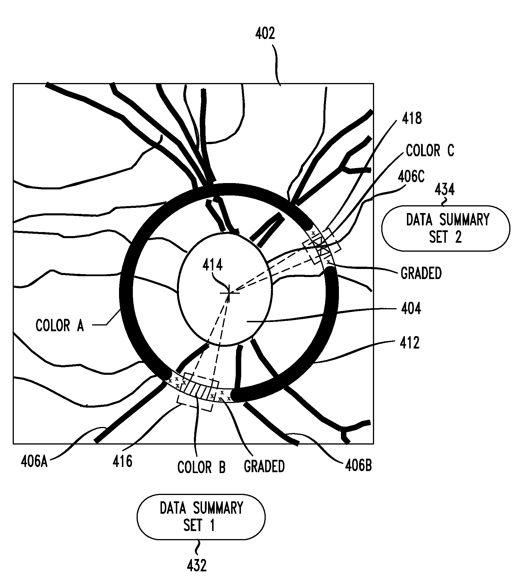 Circular Profile Mapping and Display of Retinal Parameters