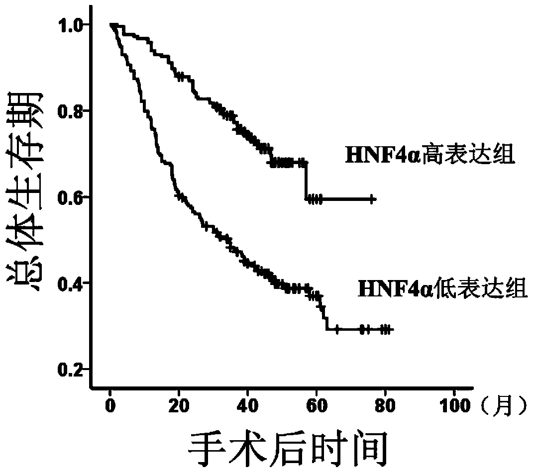 Application of HNF4 (hepatocyte nuclear factor 4) alpha proteins to preparation of liver cancer prognosis evaluation kit