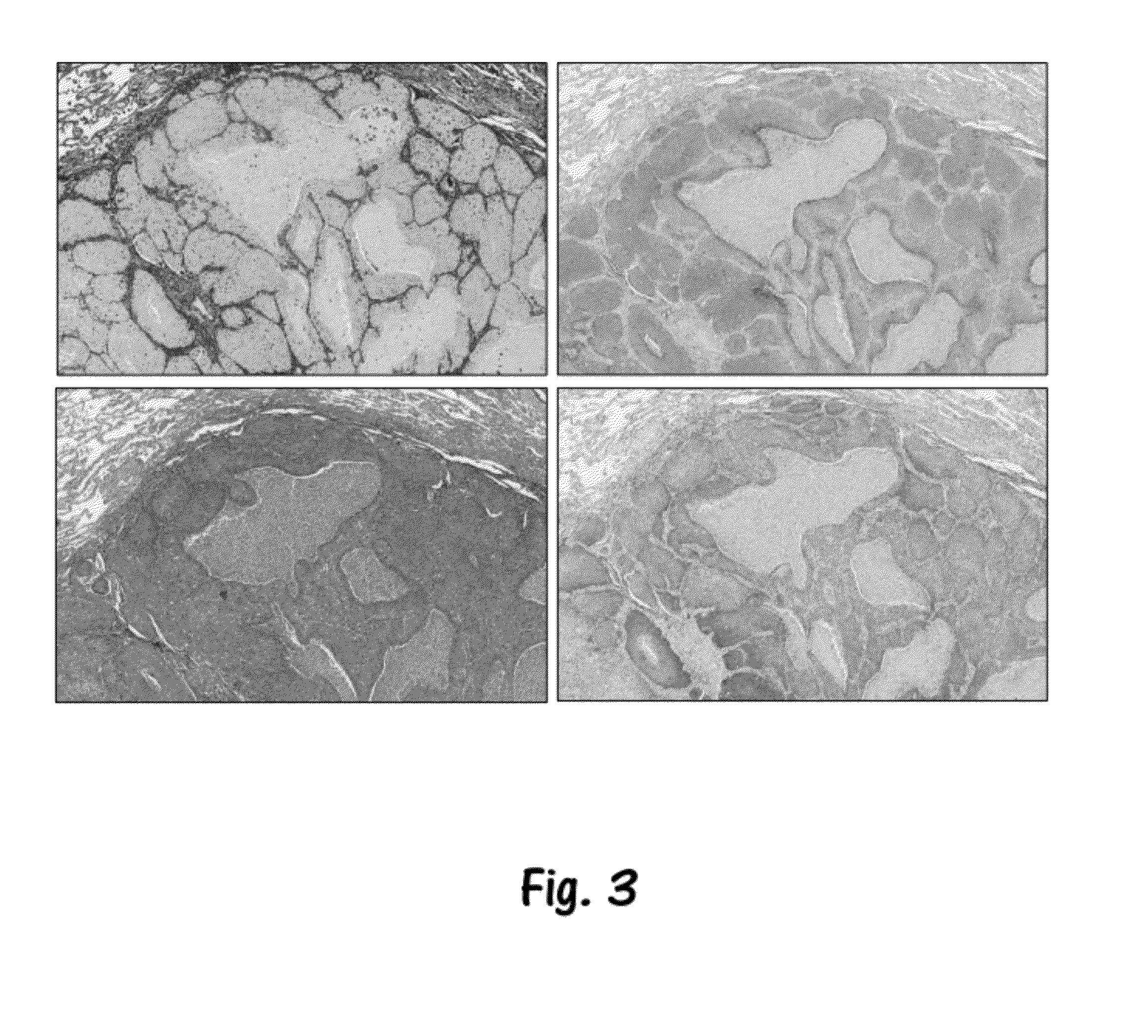 Methods for feature analysis on consecutive tissue sections