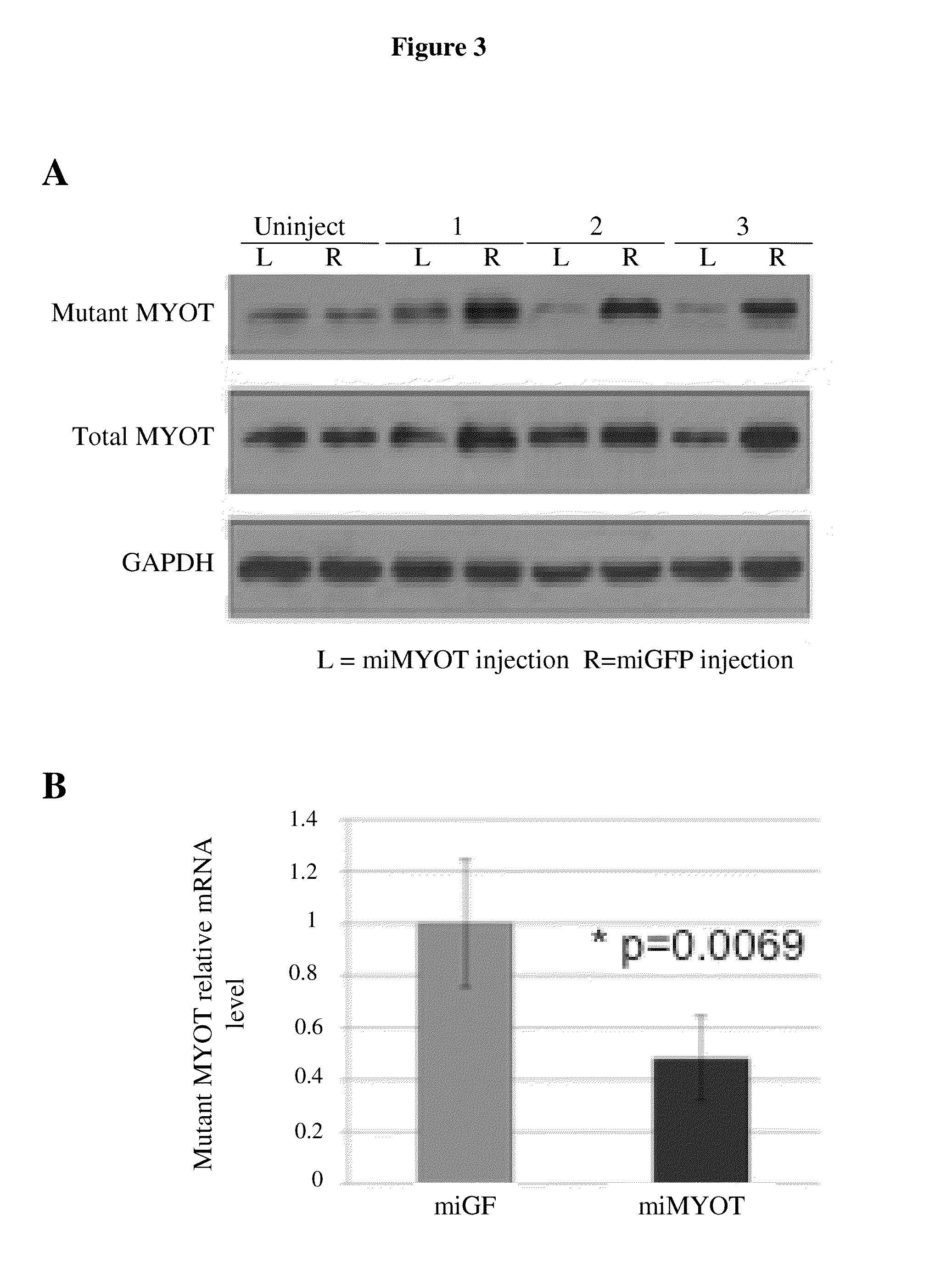 Recombinant virus products and methods for inhibition of expression of myotilin