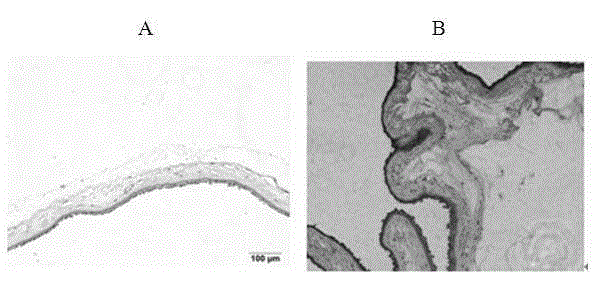 Subtotipotent stem cells of human placenta and method for constructing stem cell bank thereof