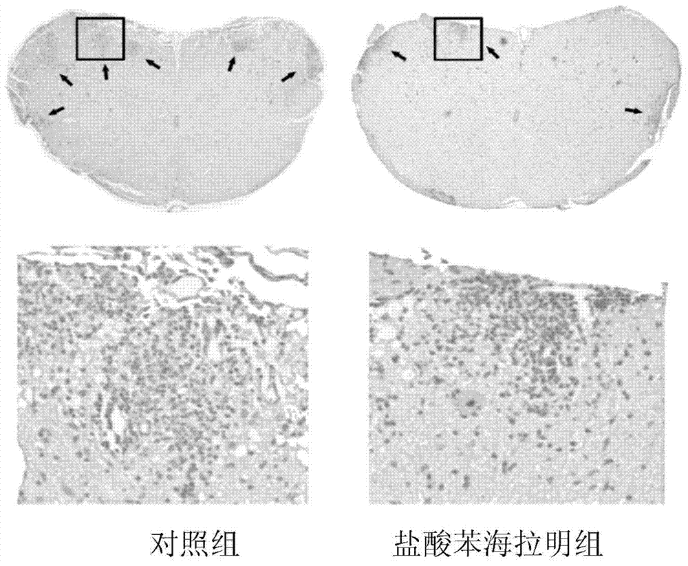 Application of diphenhydramine hydrochloride in preparation of medicine for treating experimental autoimmune encephalomyelitis