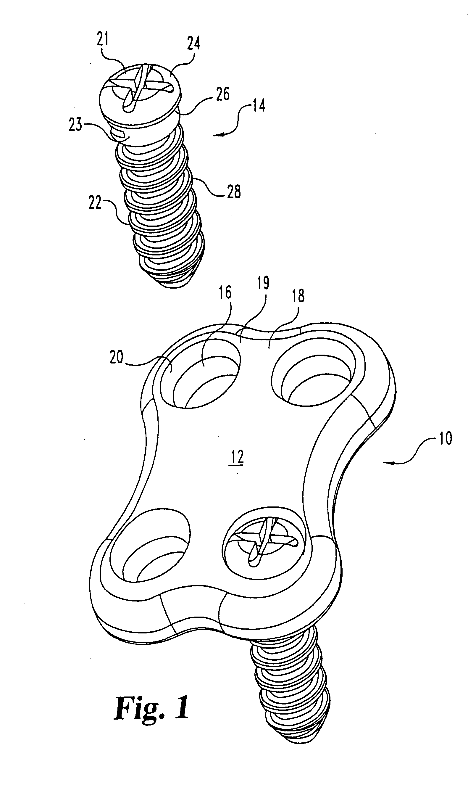 Non-metallic implant devices and intra-operative methods for assembly and fixation